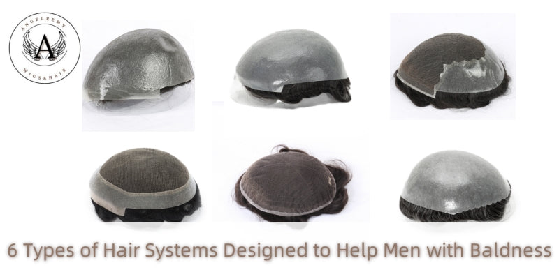 6 Types of Hair Systems Designed to Help Men with Baldness