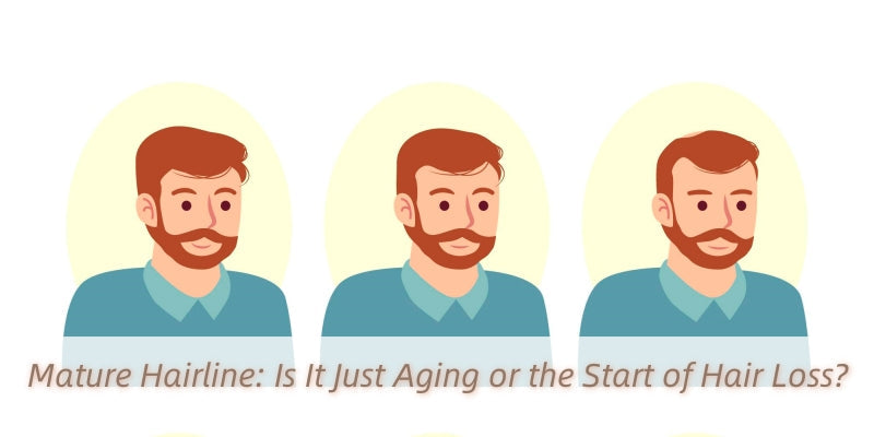 Mature Hairline: Is It Just Aging or the Start of Hair Loss?