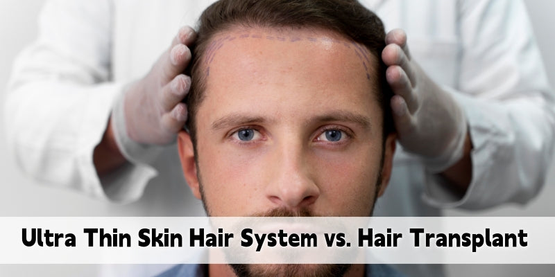 Ultra Thin Skin Hair System vs. Surgical Hair Transplant: What You Should Know