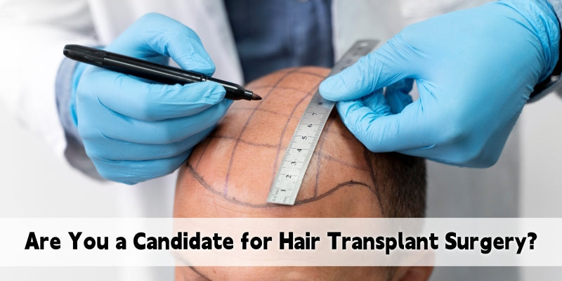 Are You a Candidate for Hair Transplant Surgery? Maybe Not—and Here's Why