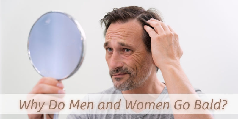 Why Do Men and Women Go Bald? And What Can You Do About It? (Hint: Hair Systems Work Wonders)