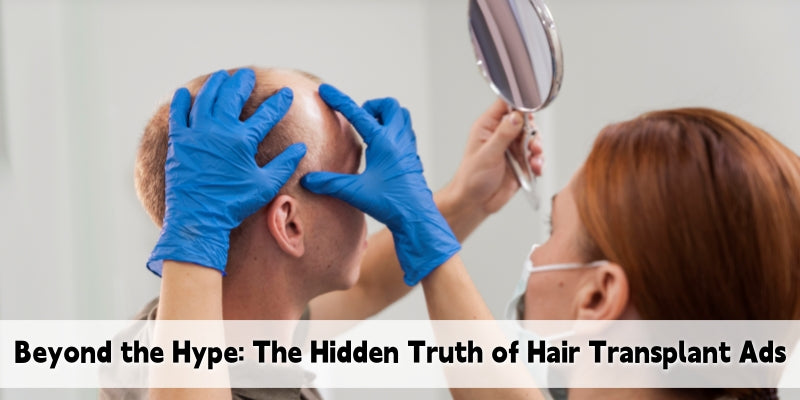 Beyond the Hype: What Hair Transplant Clinics Won’t Show You in Their Ads