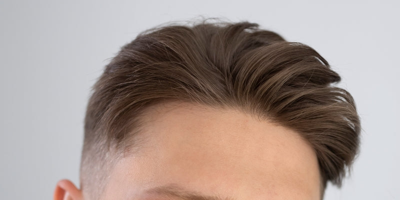 Why Natural Hairlines Are Never Perfectly Straight