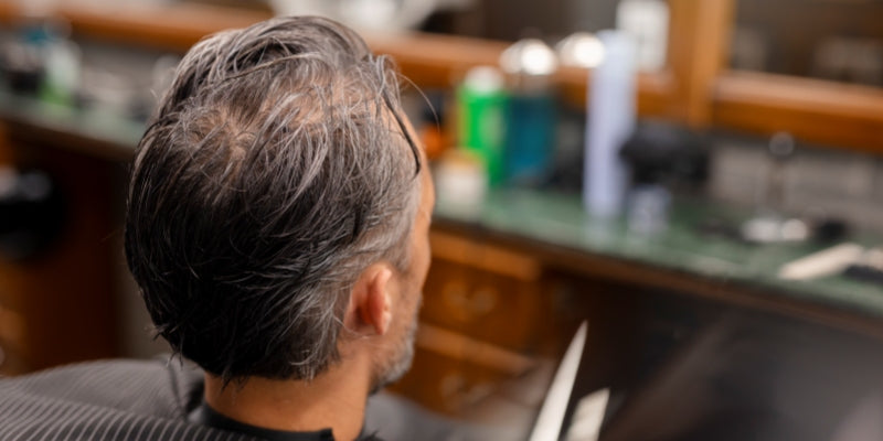 Subtle Aging — Hair Systems for Natural Transition into Thinning (Over-50 Buyers)