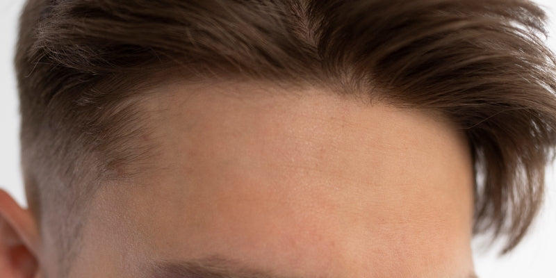 Why Some Hair Systems Look Undetectable (And Others Don’t)