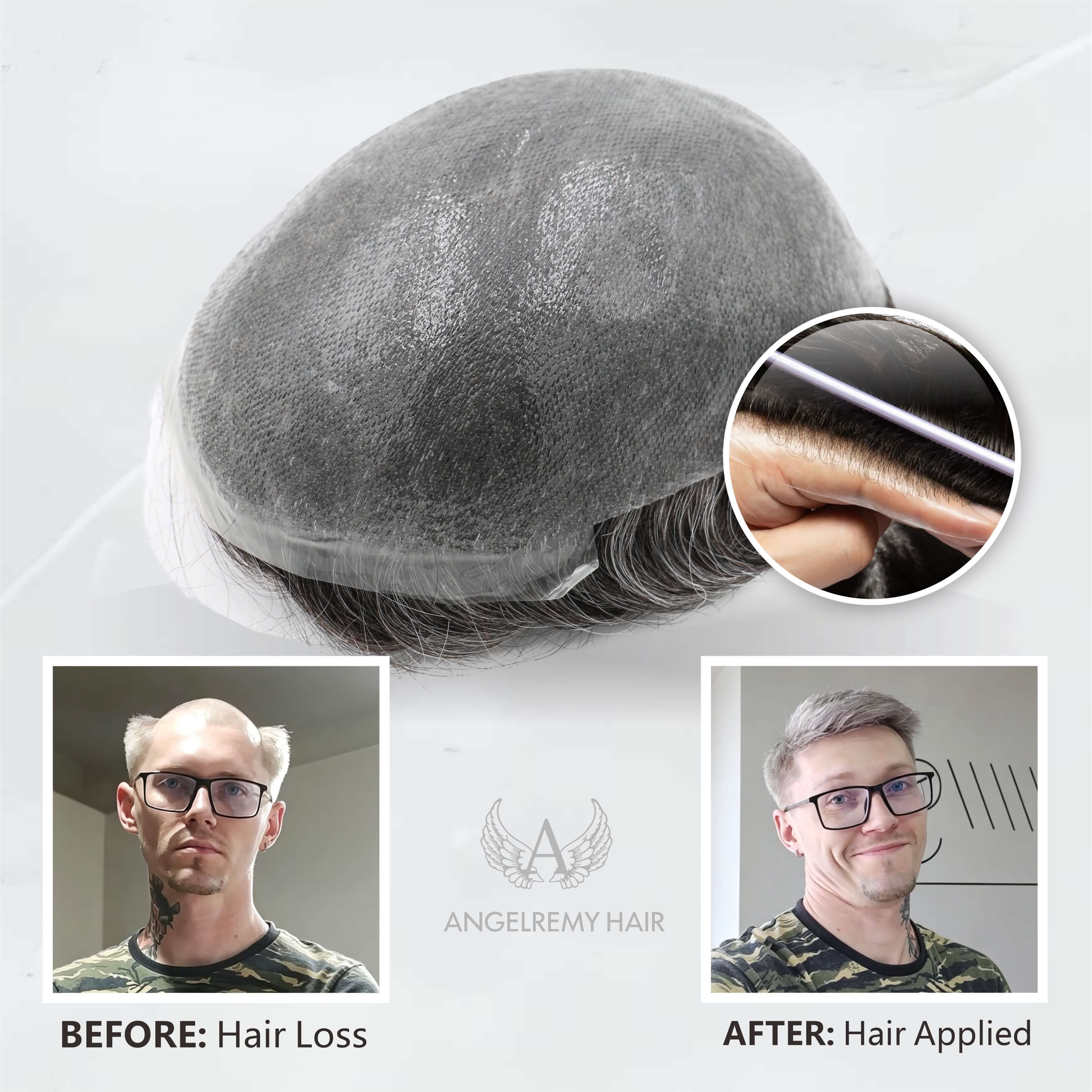 0.04–0.06mm V-Loop Ultra Thin Skin Hair System – Knotless Natural Hairline & Invisible Finish