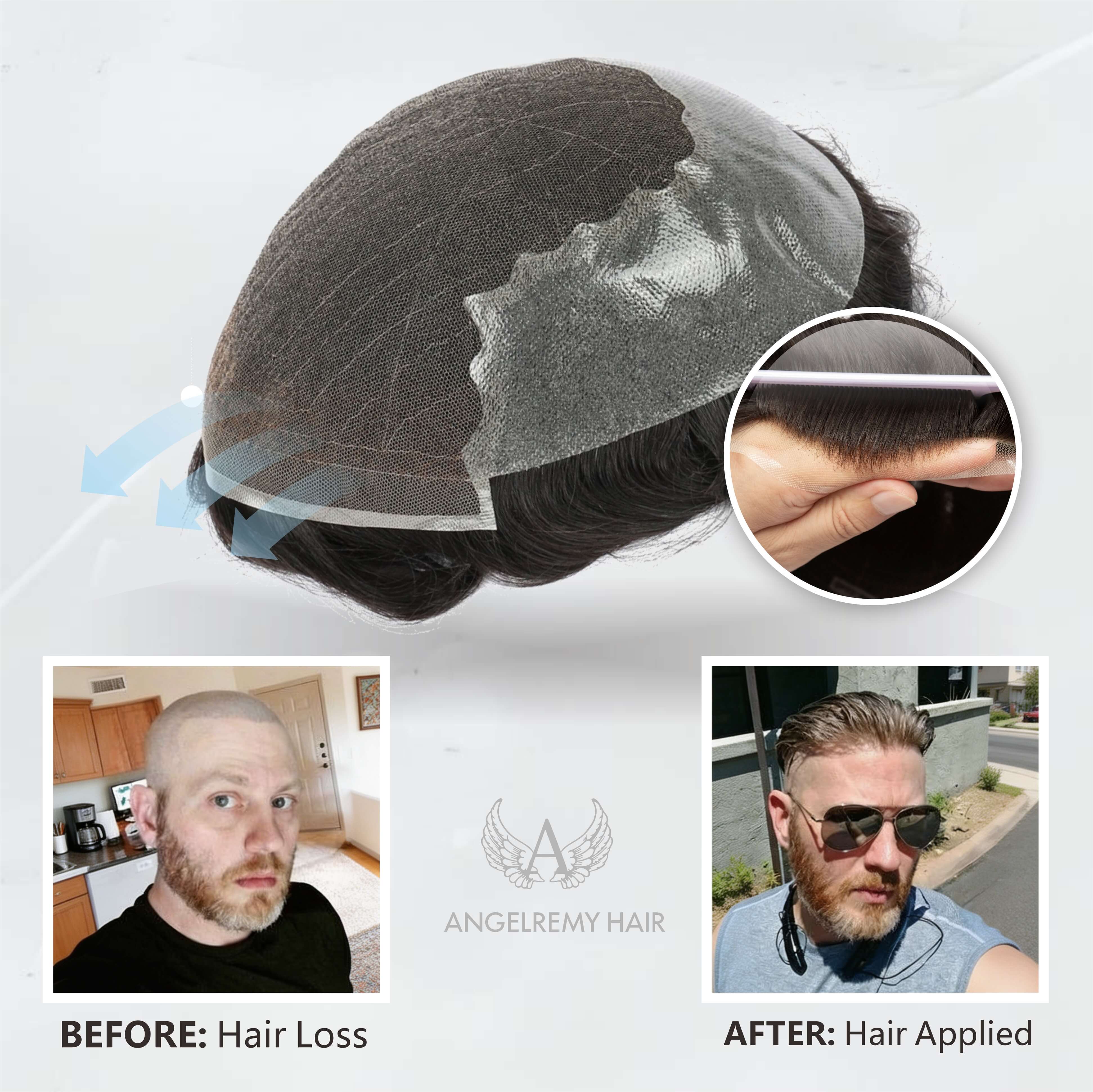 Q6 base Men's Non Surgical Hair Replacement | Swiss Lace With Skin Poly Back and Middle| Best for Daily Wear