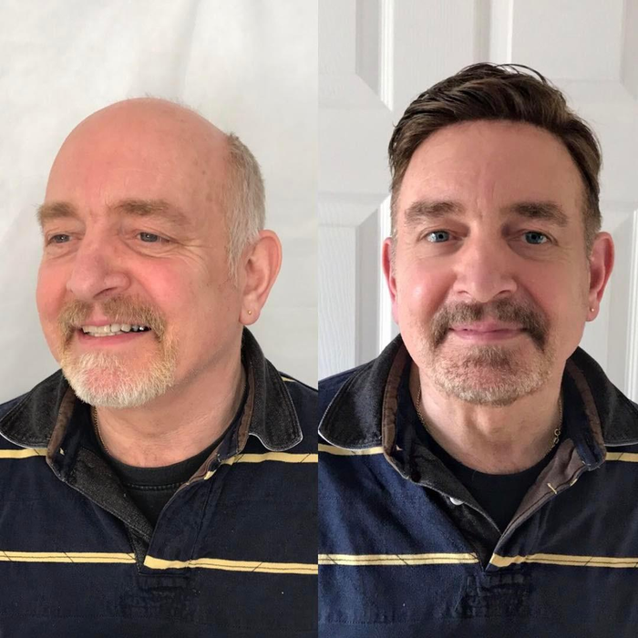 Before After