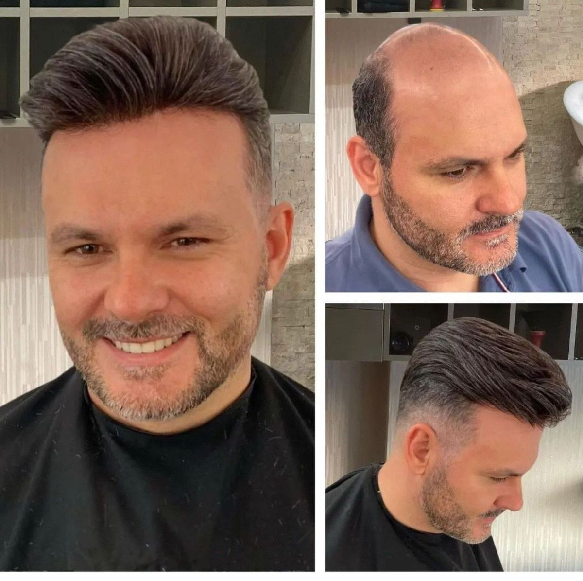 0.06-0.08 mm V Loop| Bio Skin Hair System for Men | No-shine under Lights, Blends Well with Your Skin