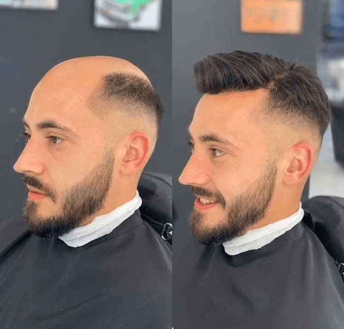 Before After