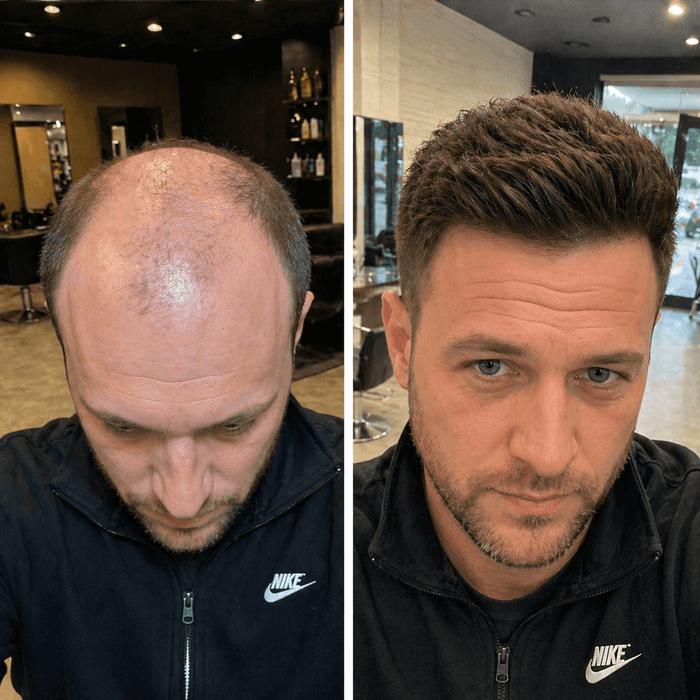 Before After