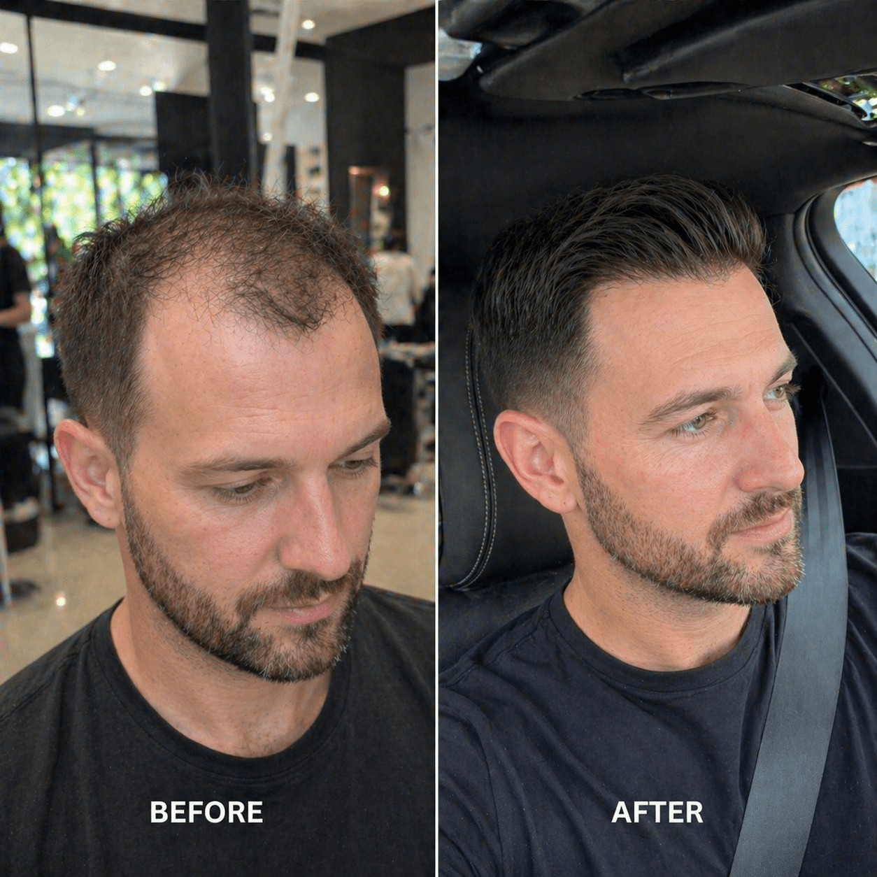 Upgrade Mirage |0.04-0.06mm Full Super Thin Skin Single Knots Base | Toupee for Men | Celebrities Choice