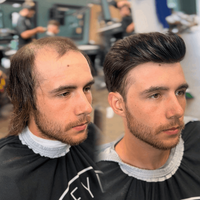 Before After