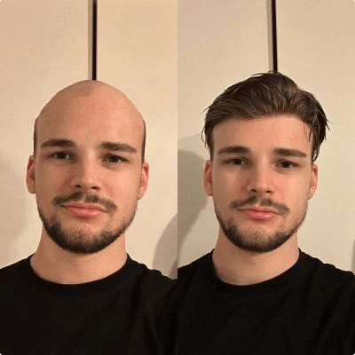 Before After