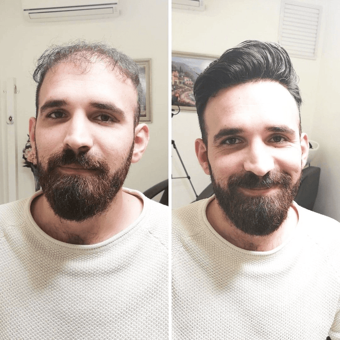 Before After